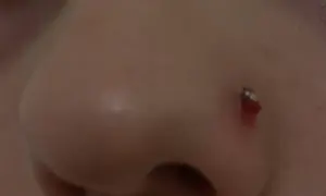 Widoczna ziarnina nostril, zaczerwieniona i lekko krwawiąca przy kolczyku. Jak się pozbyć tego problemu?